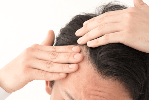 額の生え際（Ｍ字部分）の発毛具合を確認する男性
