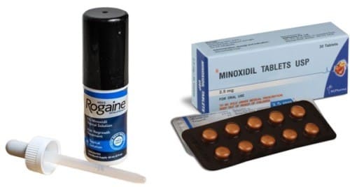 ミノキシジル外用薬とミノキシジルタブレット