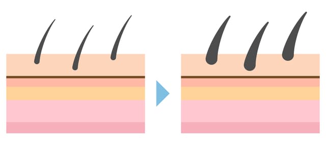 硬毛化のイメージ図