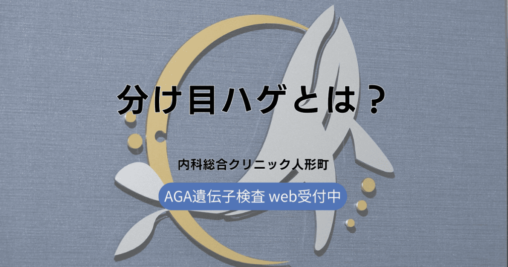 分け目ハゲとは？