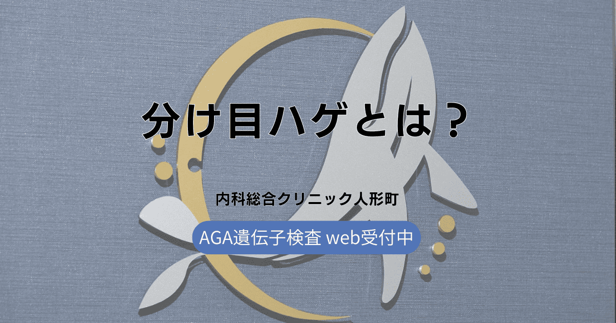 分け目ハゲとは？