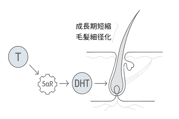 5αリダクターゼとDHT変換の作用機序｜AGAメカニズム図解
