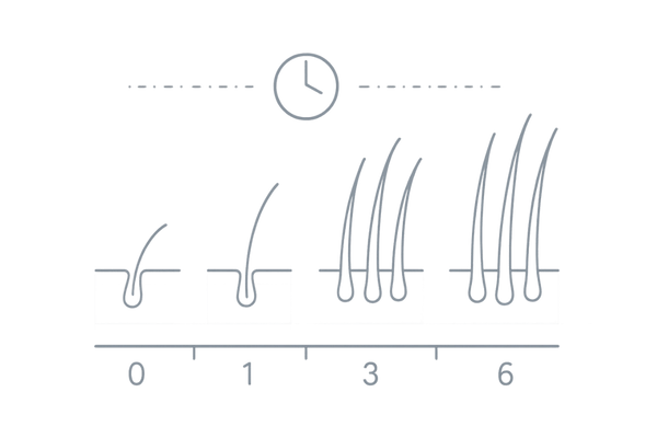 t-フラバノンの効果実感の目安｜0〜6カ月の発毛プロセス・タイムライン