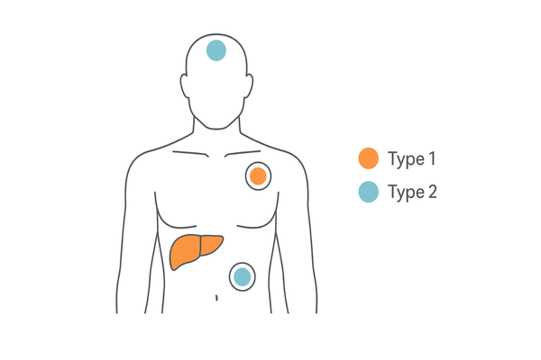 5αリダクターゼType1・Type2の体内分布と働きのイメージ図