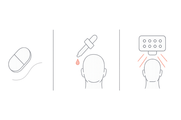 AGA治療の作用点比較イメージ｜内服・外用・光線療法の違い