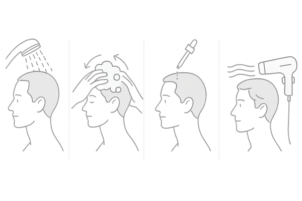 自宅でできる頭皮ケアの基本4ステップ（予洗い・やさしく洗う・保湿・ドライ）