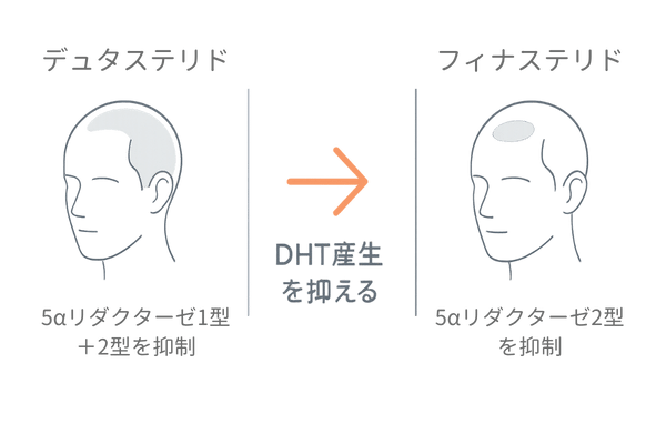 デュタステリドとフィナステリドの作用範囲の違いを説明するAGA治療イラスト