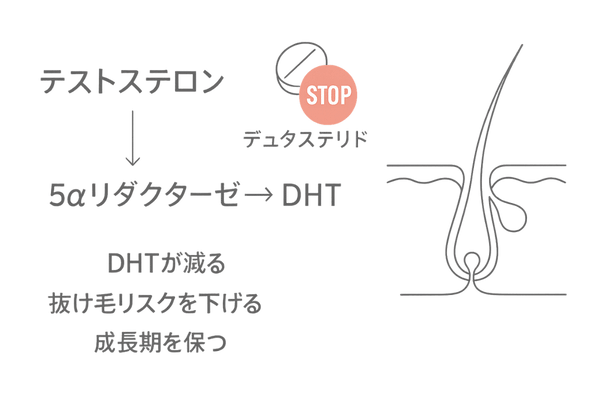 デュタステリドがテストステロンからDHTへの変換を抑える仕組みのイラスト