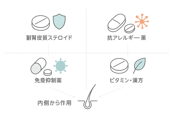 円形脱毛症｜内服薬の種類（ステロイド・抗アレルギー・免疫抑制・ビタミン/漢方）アイコン図
