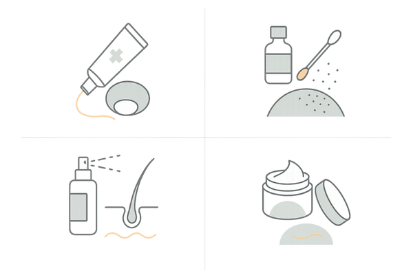 円形脱毛症｜外用薬の種類（ステロイド外用・局所免疫療法・発毛促進・かゆみ抑制）アイコン図