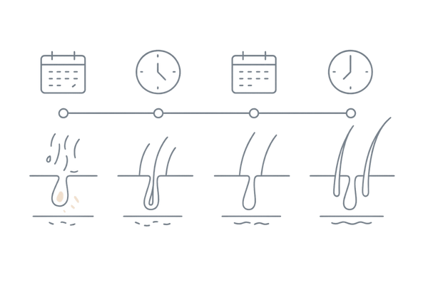 フィナステリド・ミノキシジルの効果実感タイムライン(0–12カ月)