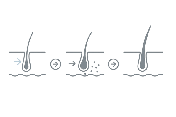ミノキシジル外用の作用イメージ：血行促進から発毛までの3ステップ