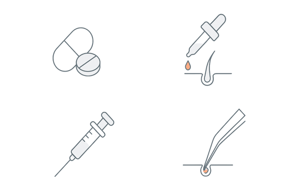 生え際のAGA治療法アイコン比較（内服薬・外用薬・注入治療・自毛植毛の位置づけ）