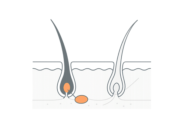 メラニン生成の低下で白髪が出るしくみを示す頭皮断面イラスト