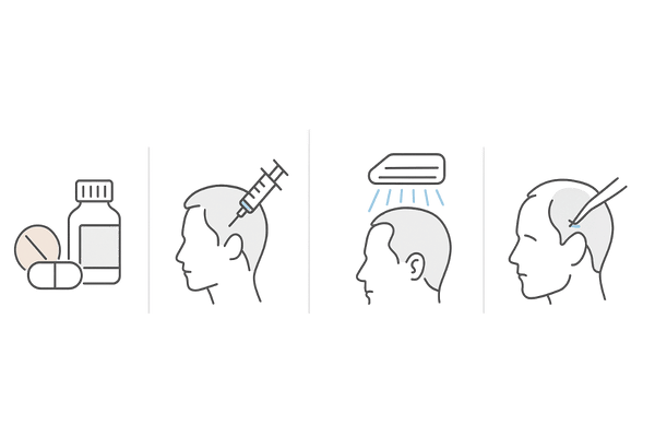 AGA治療の主な選択肢（薬・注入・照射・自毛植毛）の比較イメージ