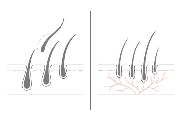 初期脱毛から回復の兆しへ:ミノキシジル使用初期の変化を2パネルで可視化
