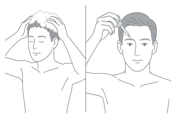 ミノキシジル配合シャンプーと育毛剤の使用シーンを比較する男性向けイラスト
