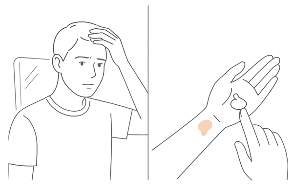 敏感な頭皮のチェックとミノキシジルシャンプー使用時の注意イメージ