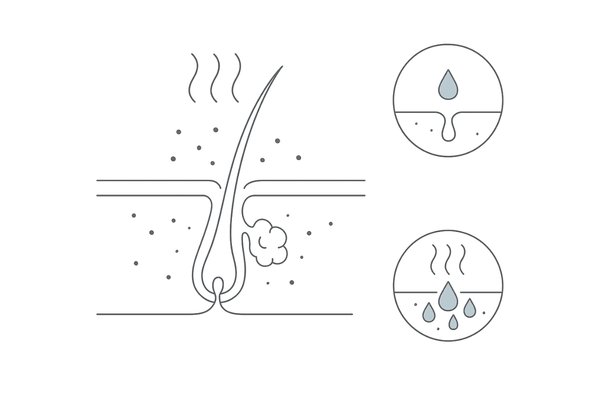 頭皮の皮脂過剰とニオイのメカニズム断面図(毛穴・皮脂腺・常在菌)