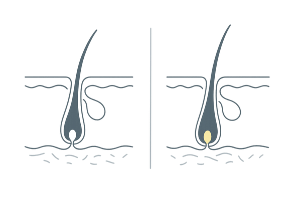 頭皮の皮脂腺とベタつきが起こる仕組みを説明するイメージ