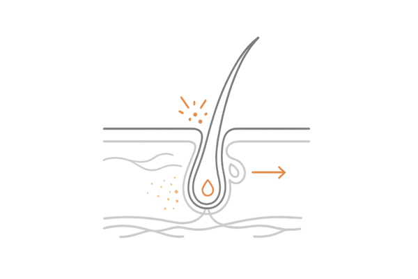 頭皮が痛い原因のメカニズム図解｜毛包炎・皮脂・血行・神経の関係