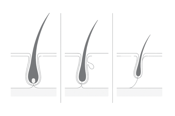 毛周期（成長期・退行期・休止期）の比較イラスト｜頭皮断面