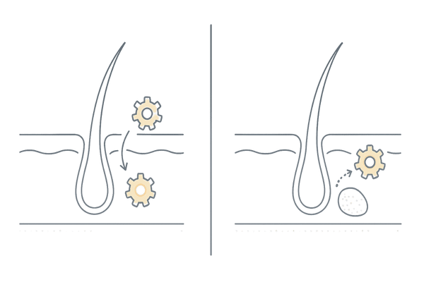 ザガーロとフィナステリドの作用範囲比較｜5αリダクターゼ1型・2型へのアプローチ