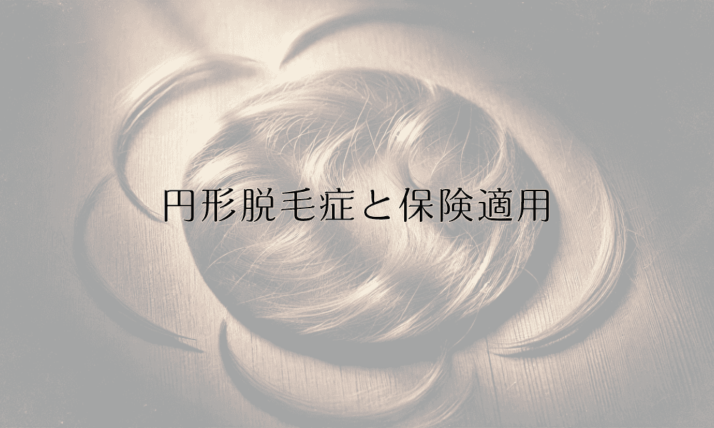 円形脱毛症と保険適用 - 治療費と給付の基礎知識