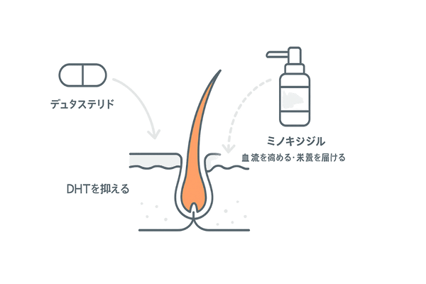 デュタステリドとミノキシジル併用の相乗効果メカニズム図｜ホルモンと血流の2方向アプローチ