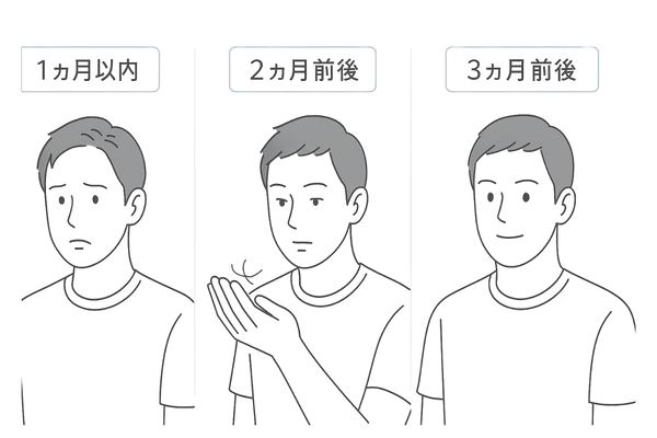 フィナステリド服用開始～3ヶ月までの変化タイムライン図（抜け毛減少が先に来る流れ）