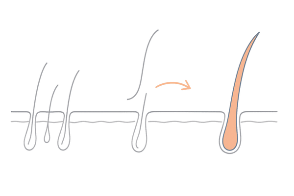 フィナステリド初期脱毛のイメージ（毛周期リセットの流れ）