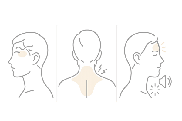 フィナステリド服用中に起こりやすい頭痛タイプの比較図