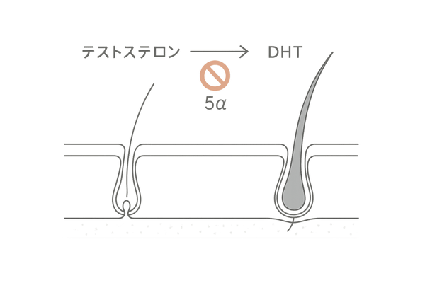 フィナロイドがDHTを抑えてAGA進行を防ぐ仕組みのイラスト