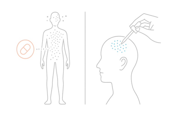 フィナステリド外用と内服の違い比較イメージ