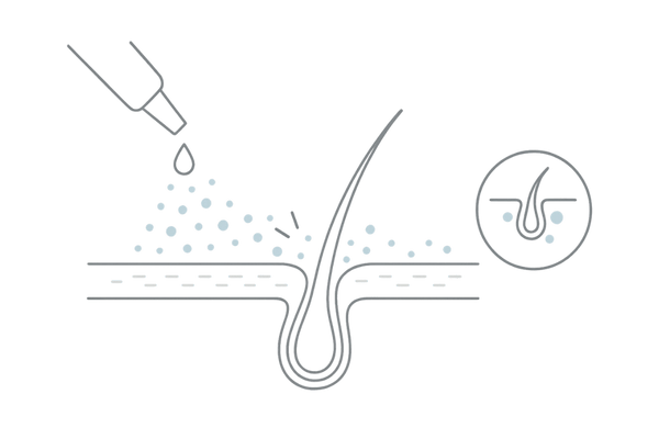 フィナステリド外用薬の吸収率と浸透課題イメージ