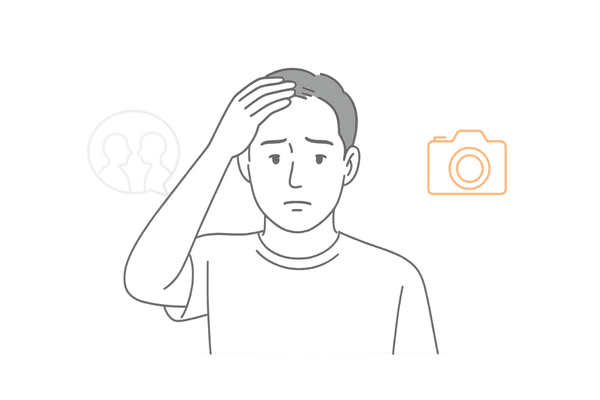 前頭部の薄毛による心理的負担に悩む男性のイメージ