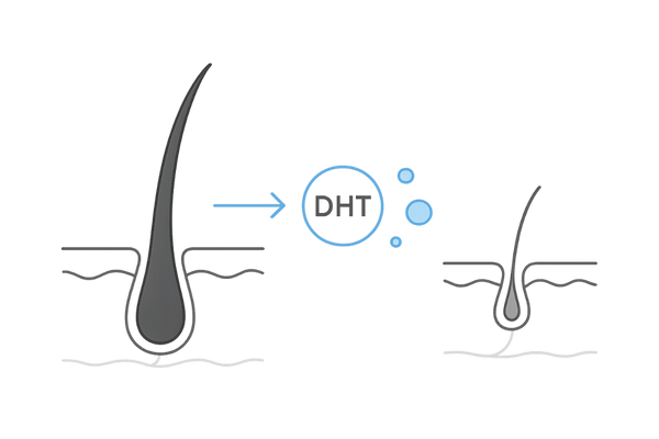 AGAの初期進行メカニズムと毛包の変化イメージ