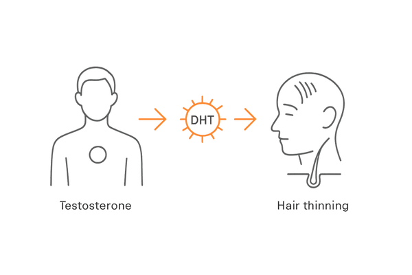 男性ホルモンとDHTが薄毛を進行させる仕組み図（テストステロン→DHT→毛包への影響）