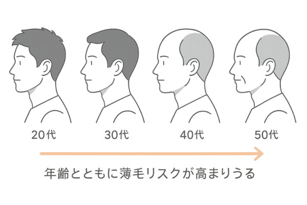 何歳からはげるか年代別に解説する男性の薄毛進行イメージイラスト