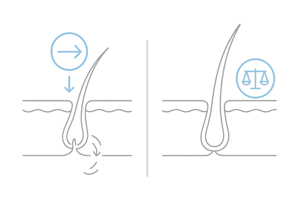 大豆イソフラボンとAGA（DHT）の関係を示す頭皮メカニズム図