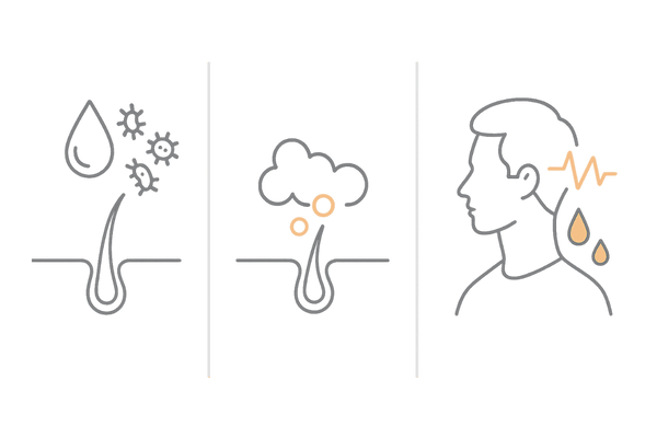 頭皮のにおいを強める原因（汗・すすぎ残し・ホルモン乱れ）の比較イメージ