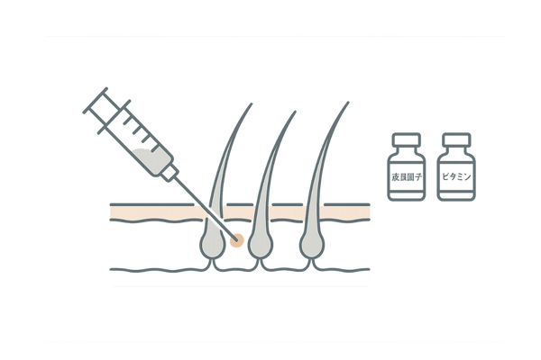 頭皮にメソセラピーを行うAGA治療イメージ図