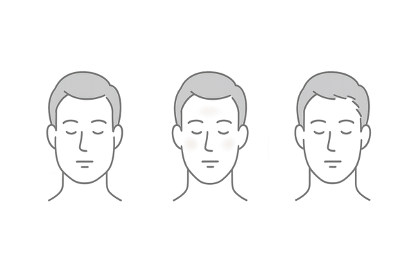 ミノキシジルで老けて見えると感じる理由（むくみ・赤み・産毛のイメージ）