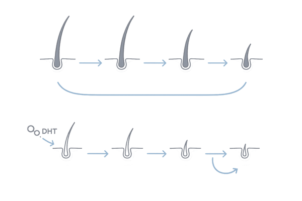 AGAと老化の関係（DHT影響と毛周期短縮の図）