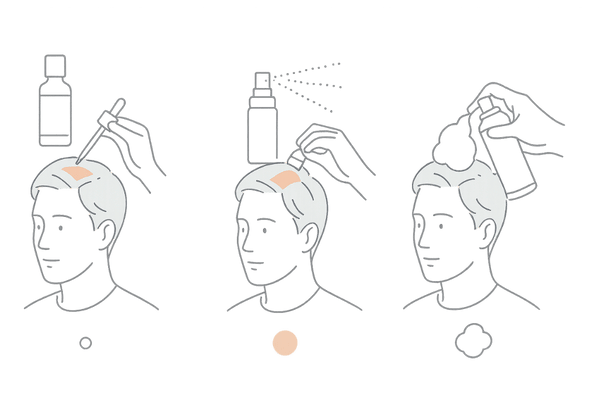 ミノキシジル外用薬のタイプ別特徴（ローション・スプレー・フォーム）