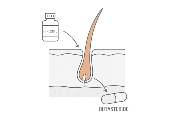 ミノキシジルとデュタステリド併用による相乗効果のイメージ図（血行促進＋DHT抑制）