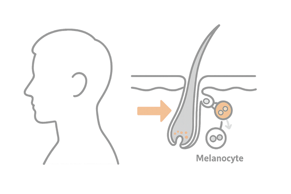 白髪が生じる仕組みとメラノサイト低下を示す模式図