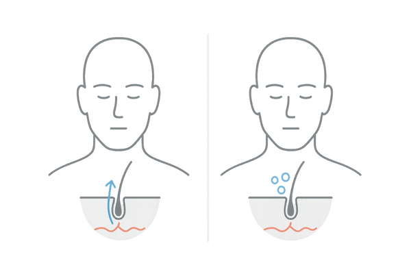 ミノキシジルの作用と男性ホルモンの関係図