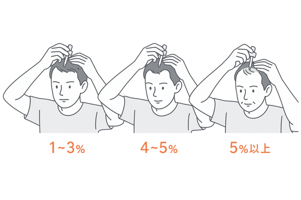 ミノキシジル外用薬の濃度別効果比較