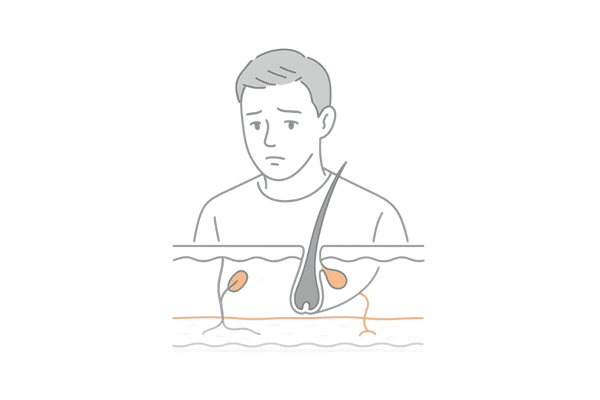 頭皮の痒みと頭皮の構造｜皮脂腺や毛包の特徴イメージ